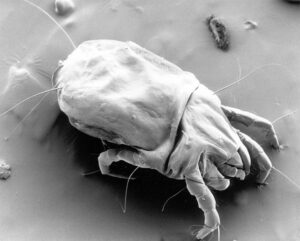 Image from Wikipedia: CSIRO Science Image_11085: Scanning electron micrograph of a female dust mite